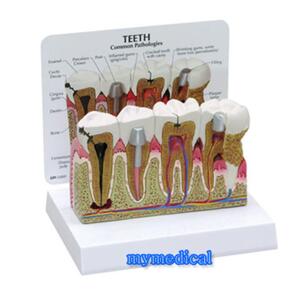미제 치아모형 단면 고급형 교육용 G286