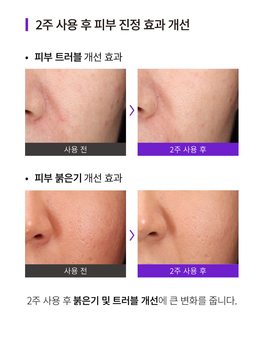 악세사리 상품상세 이미지-S17L4