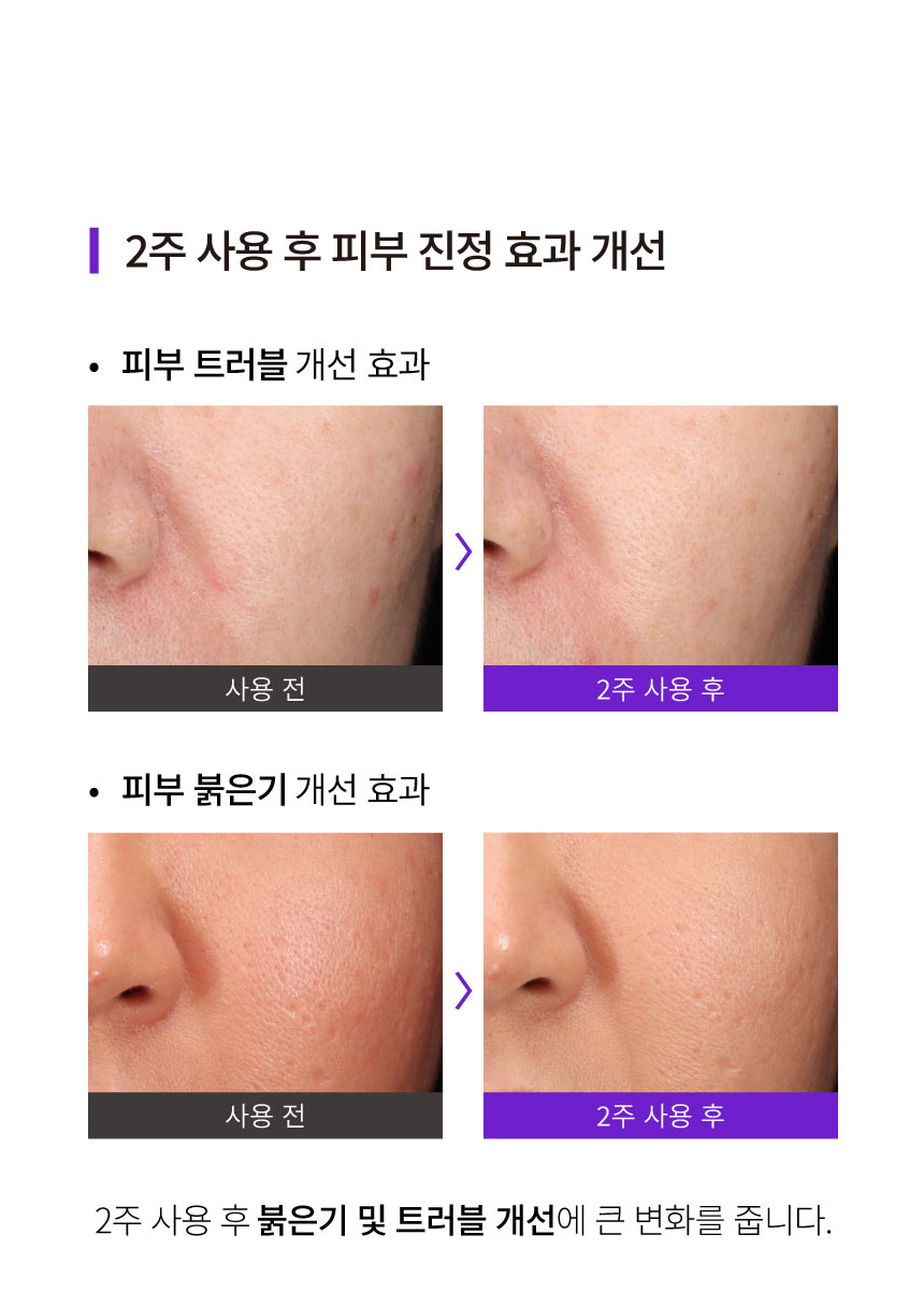 악세사리 상품상세 이미지-S20L6