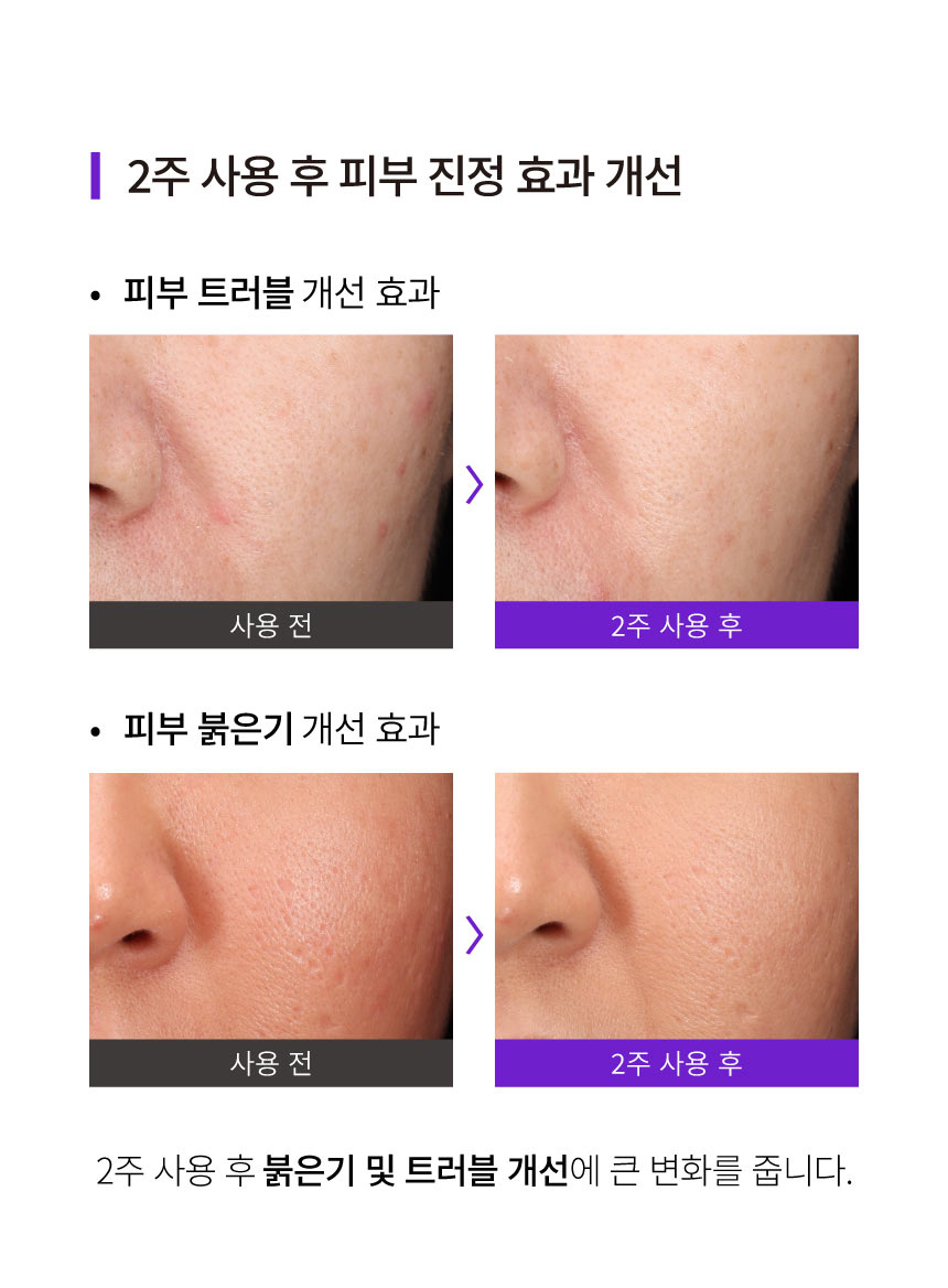 악세사리 상품상세 이미지-S28L62