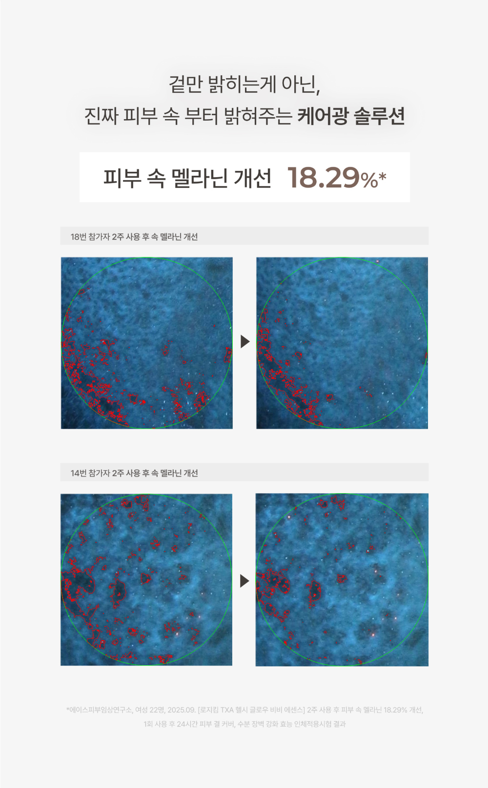 악세사리 상품상세 이미지-S6L36