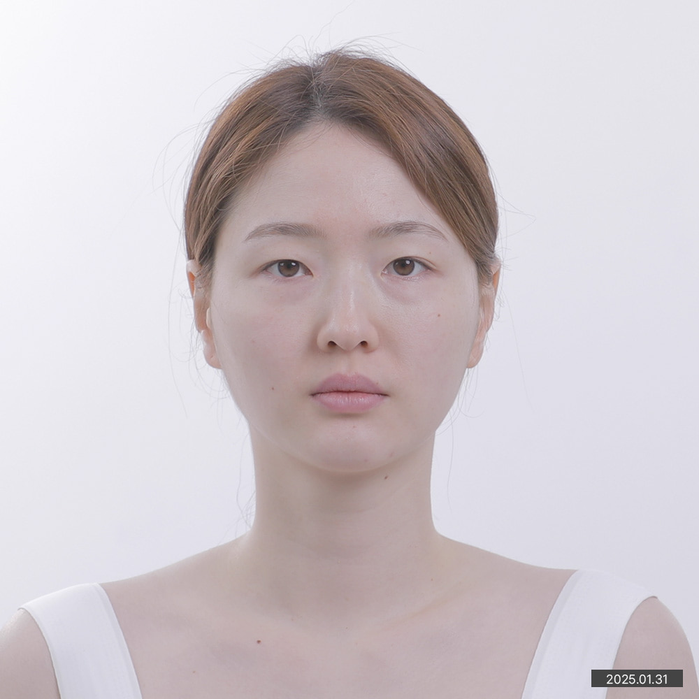 이미지2