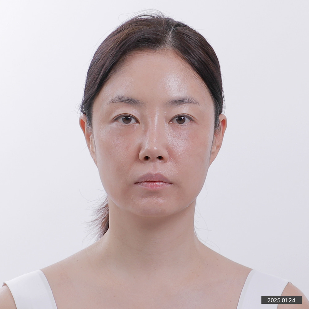 이미지1