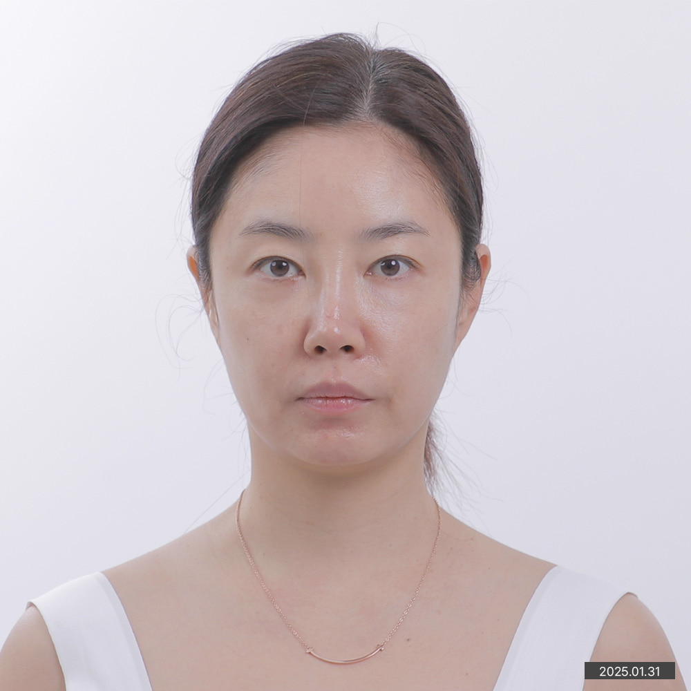 이미지2