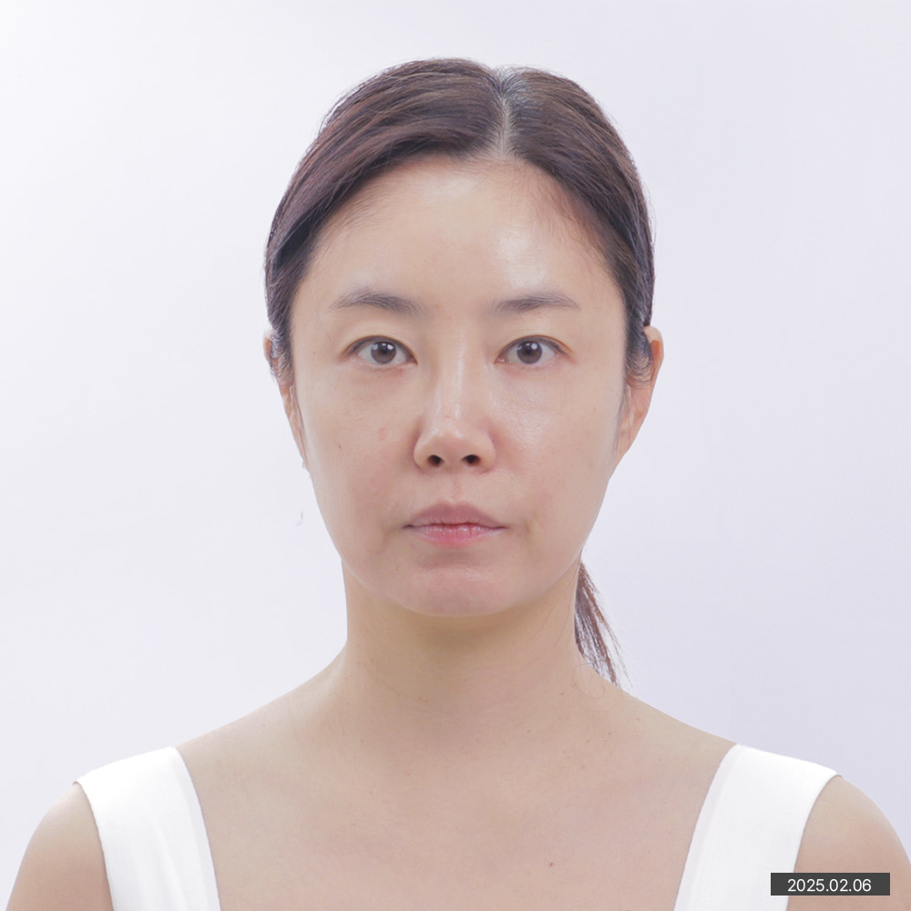 이미지3