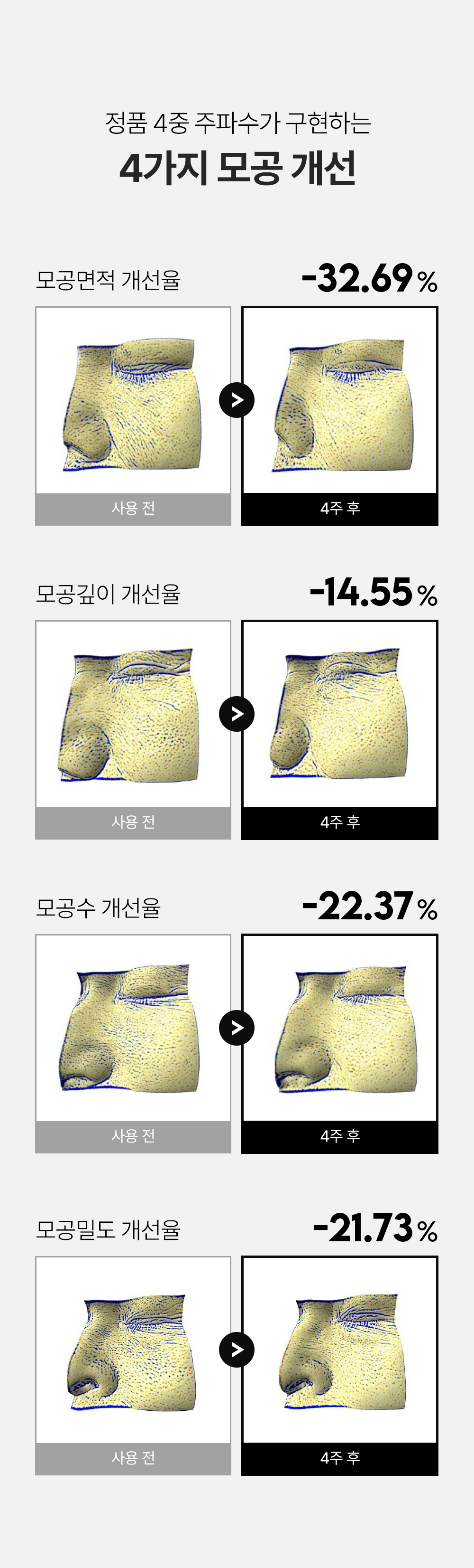 화장품 상품 이미지-S142L4