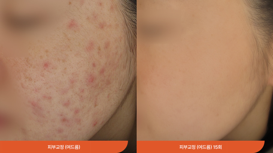 敏感性皮肤治疗