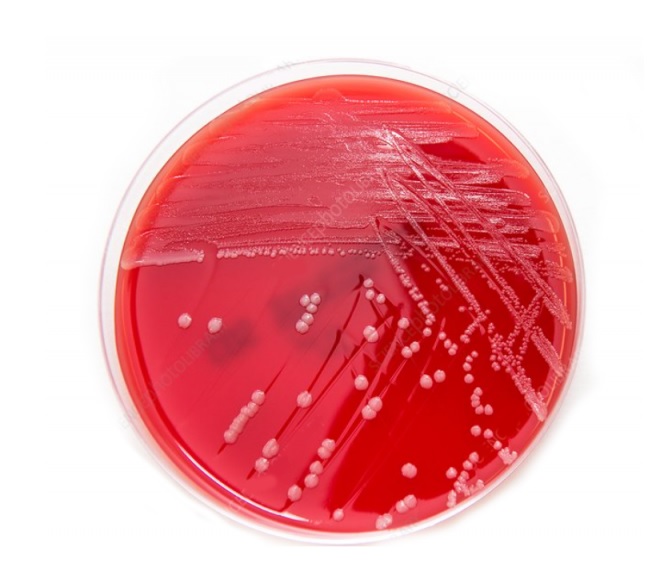 Ba Plate Blood Agar Plate - 사이언스툴