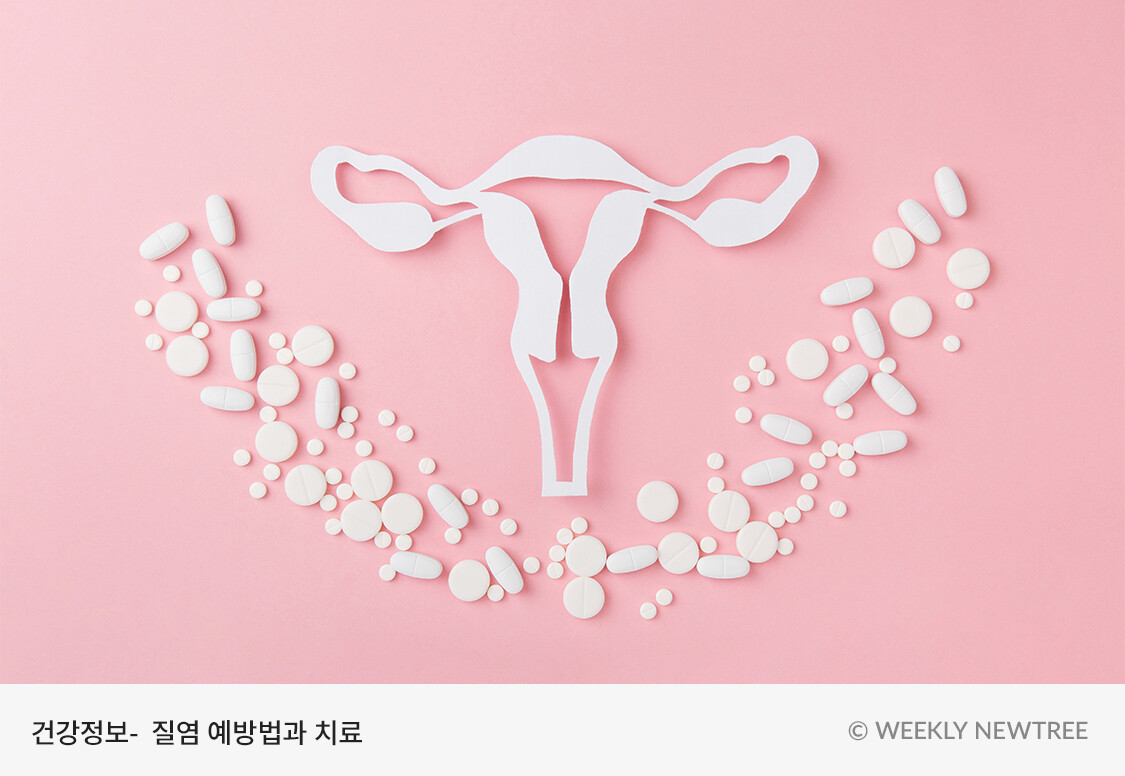 질염 냄새는 질 건강의 위험 신호/평소와 달리 질 분비물이 많아지거나 나쁜 냄새가 난다면 질염의 신호일 수 있습니다. 질염은 질 내  환경에 변화가 생겨 유해균이 증식하게 되면 발생하게 됩니다. 발병 시, 생선 비린내와