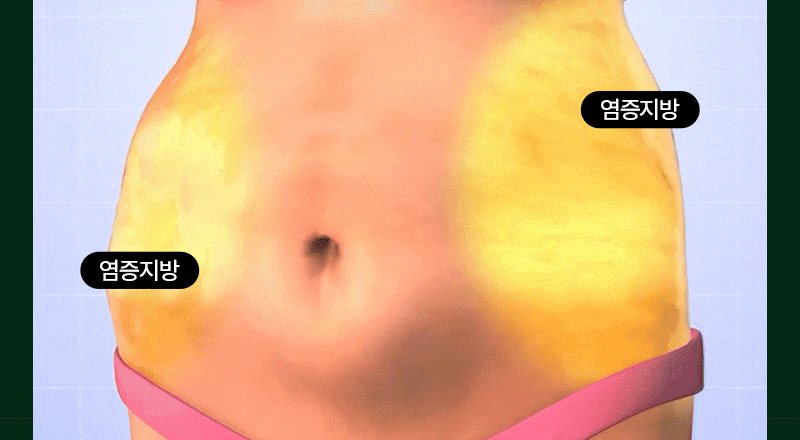 메디리즈 핏톡스네오틴 상세페이지