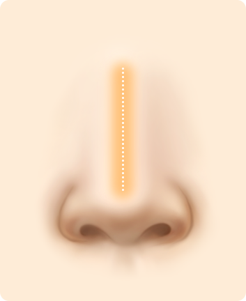 Nose Shape Correction