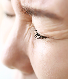 Ptosis Correction