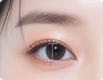 Ptosis Correction