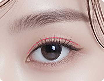 Ptosis Correction
