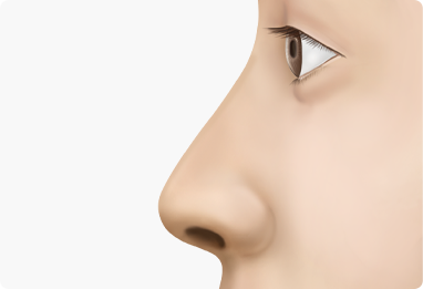 Nose Shape Correction