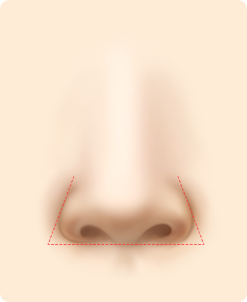 Alar Base Reduction