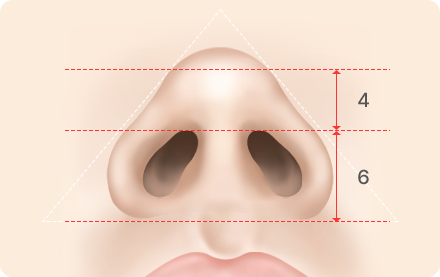 Alar Base Reduction