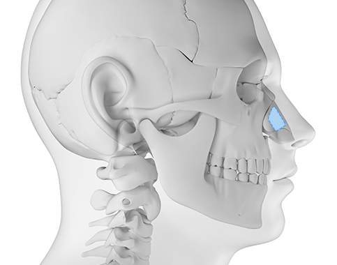 Functional Rhinoplasty