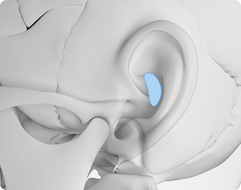 Functional Rhinoplasty