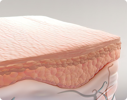 Functional Rhinoplasty