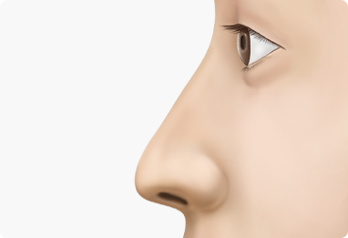 Nose Shape Correction