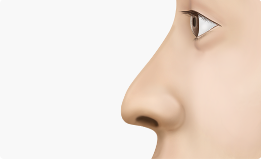 Nose Shape Correction