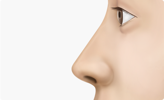 Nose Shape Correction