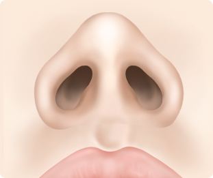 Nose Shape Correction