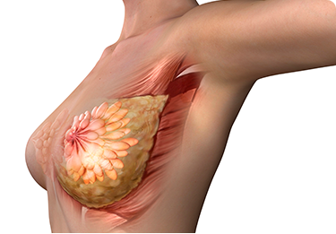 Breast Reduction