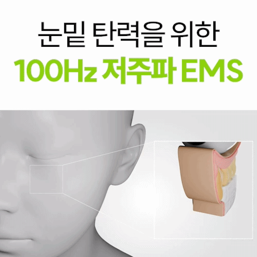 알파킷 아이코어샷 | 알파킷 Alphakit