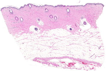 Skin(pig)