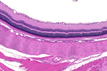 Retina, eye(rat)