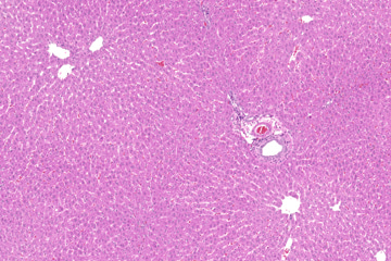 Liver(rat)