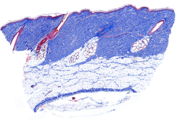 Masson's Trichrome