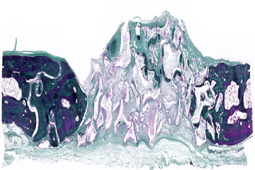 Goldner's Trichrome