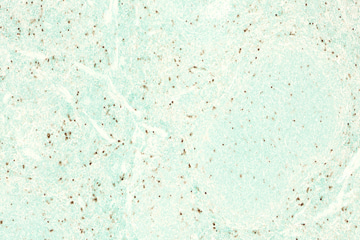 TUNEL stain