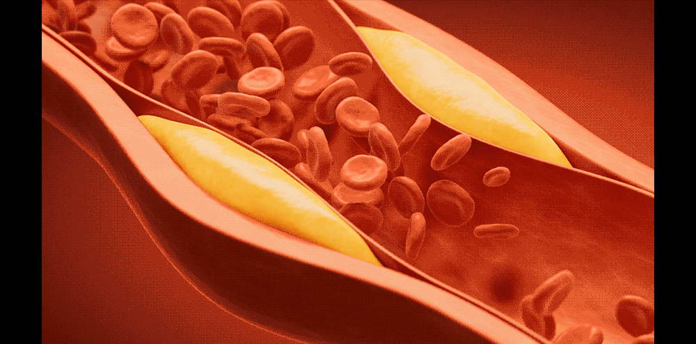 시계 상품상세 이미지-S4L11