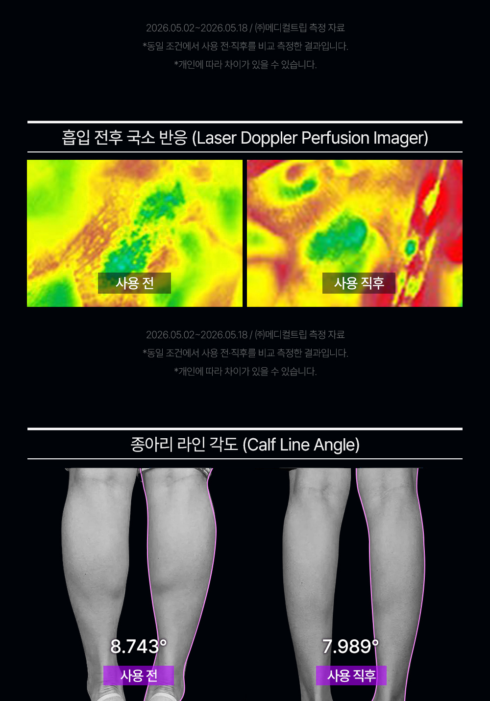 화장품 상품 이미지-S127L6