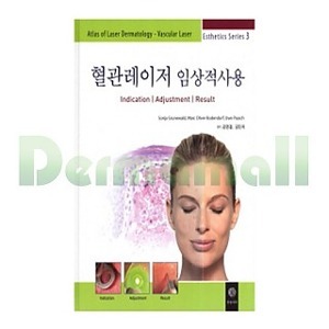 혈관레이저 임상적사용(역자 : 김영걸 감수)