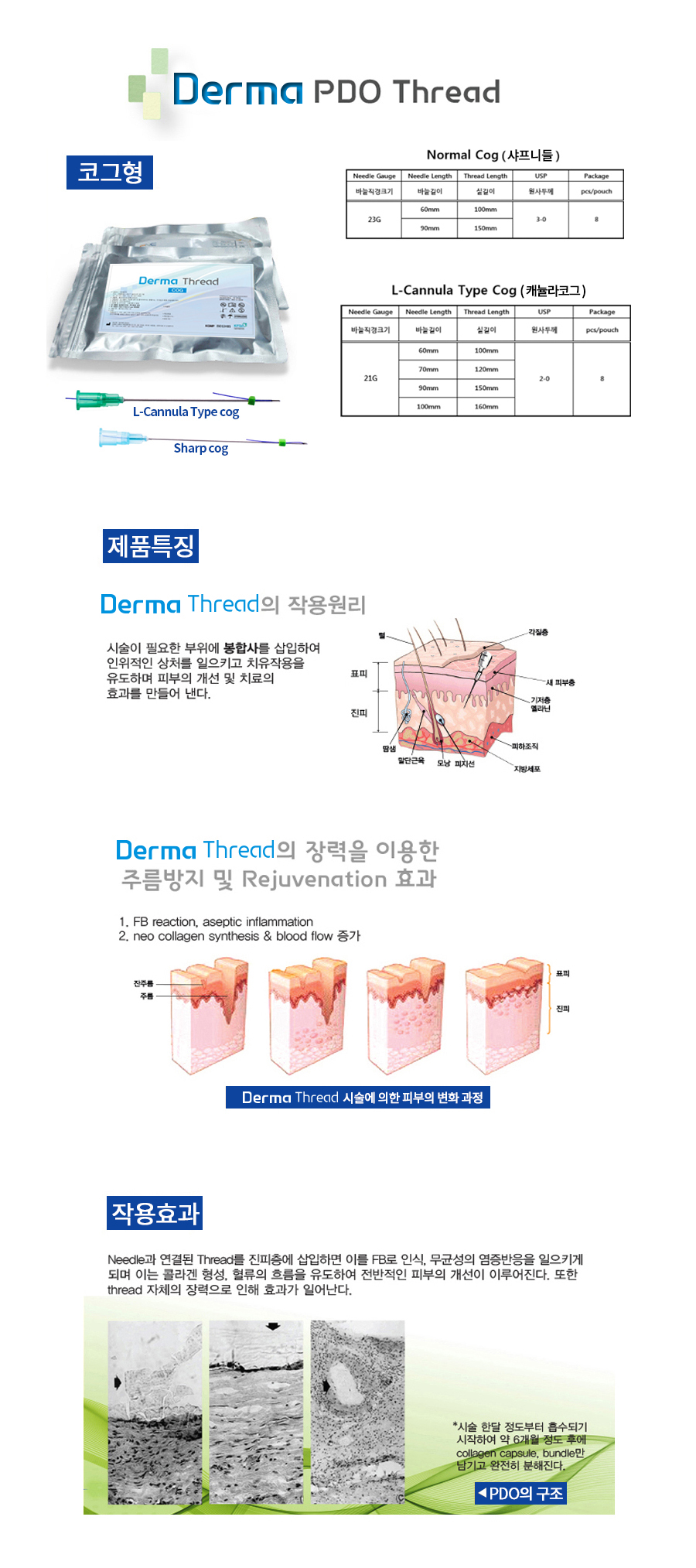 PDO 녹는실 (코그실) Derma Thread(더마쓰레드)_Cog needle_24개(3팩) 상세이미지 1