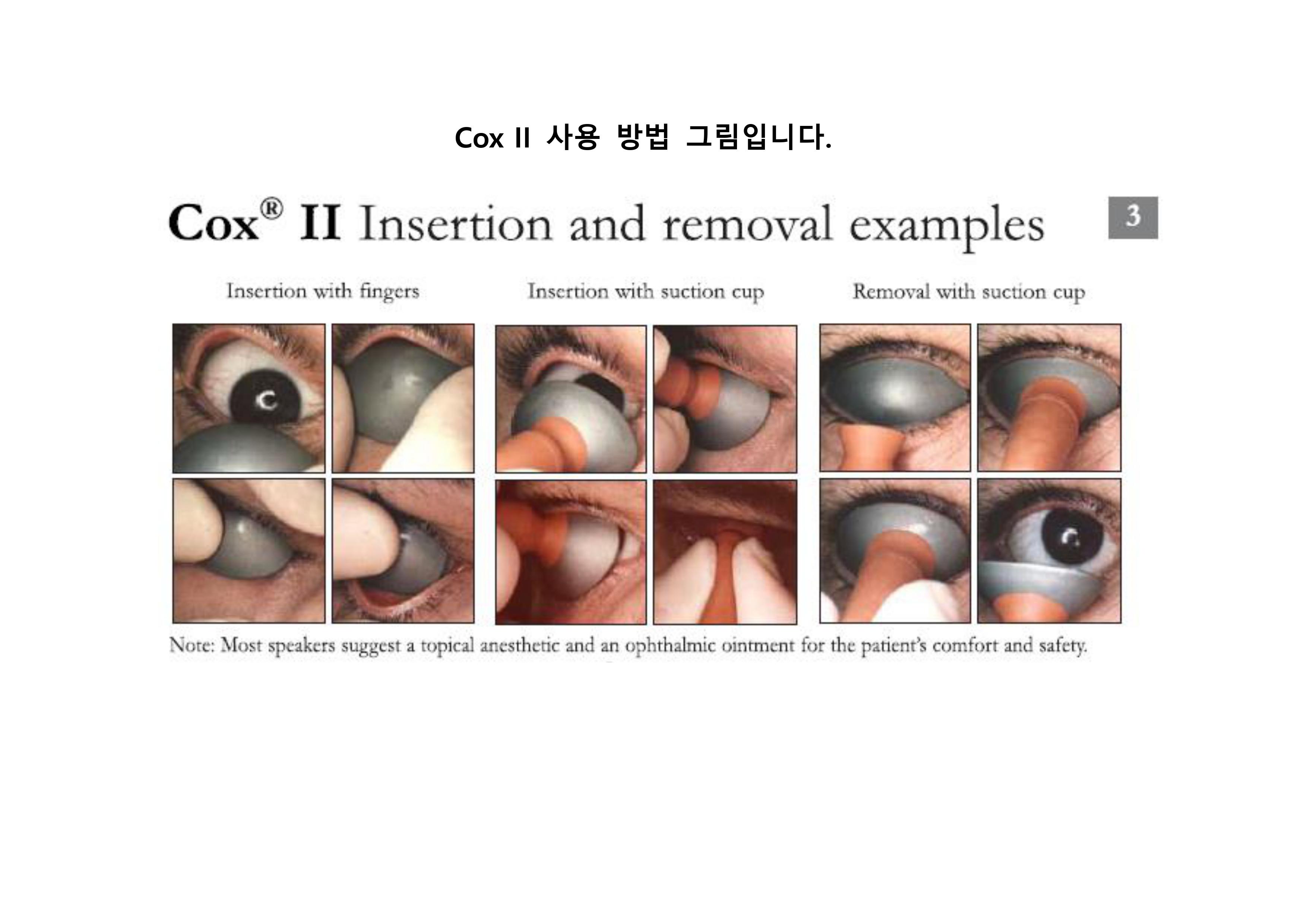 [고무팩 증정 이벤트]아이쉴드 (Eye-Shield) SIZE : S 상세이미지 1