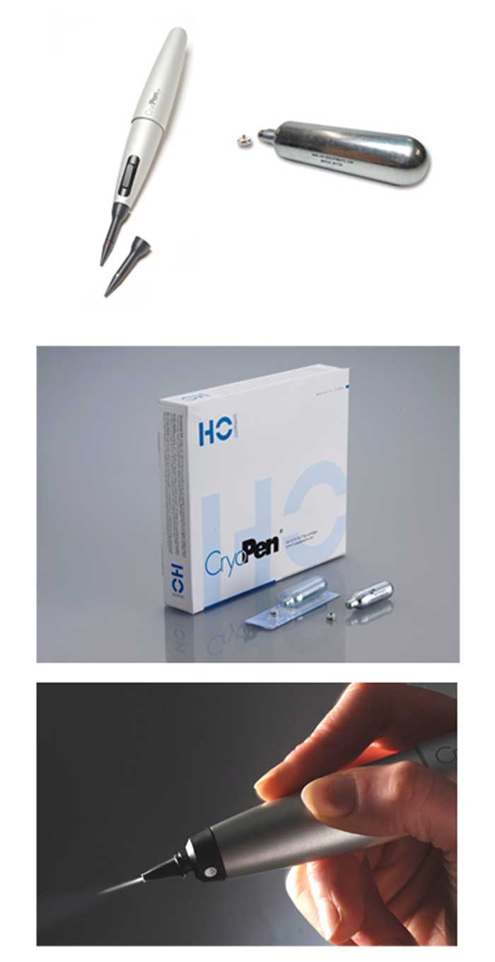 크라이오펜(CryoPen)_16g 상세이미지 2