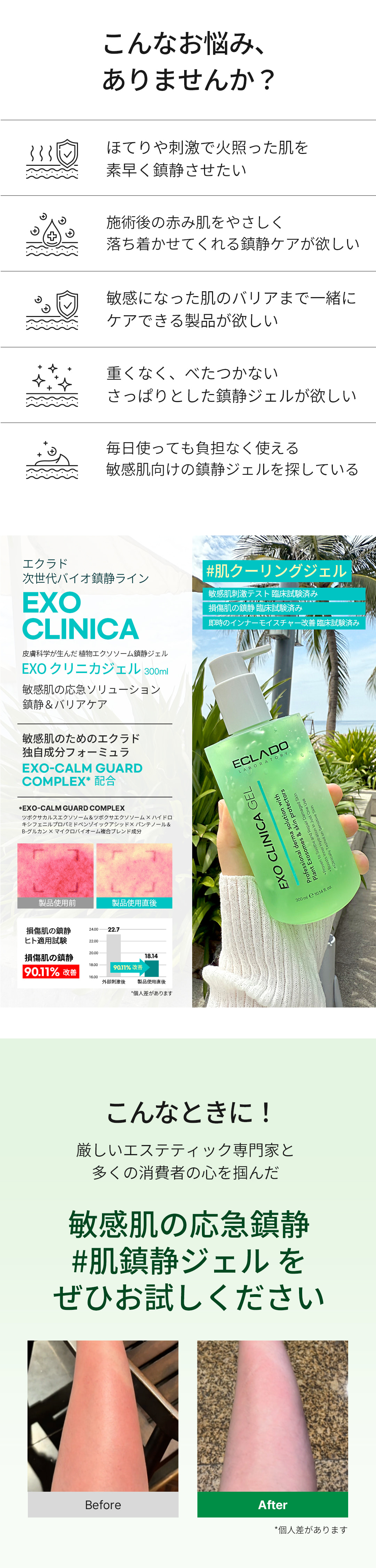 Eclado] EXO Clinica Gel 300ml - Anna's DAZZ