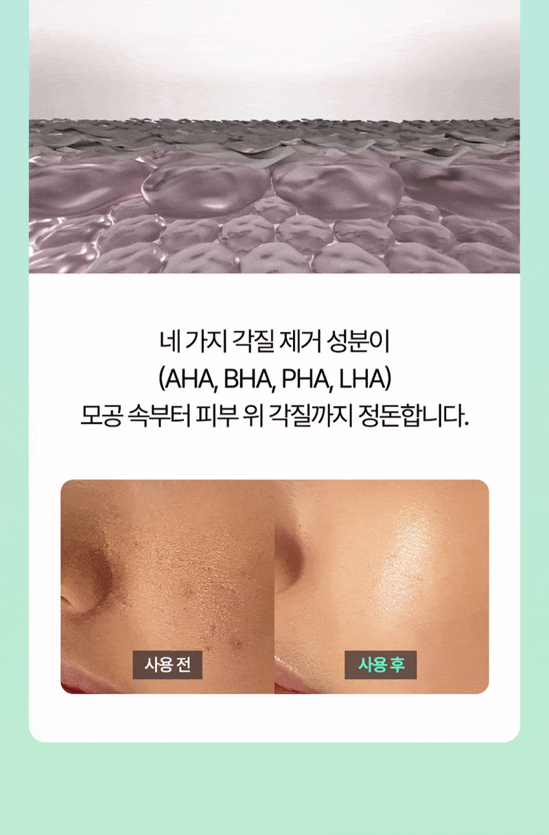 토너패드 상세이미지 22