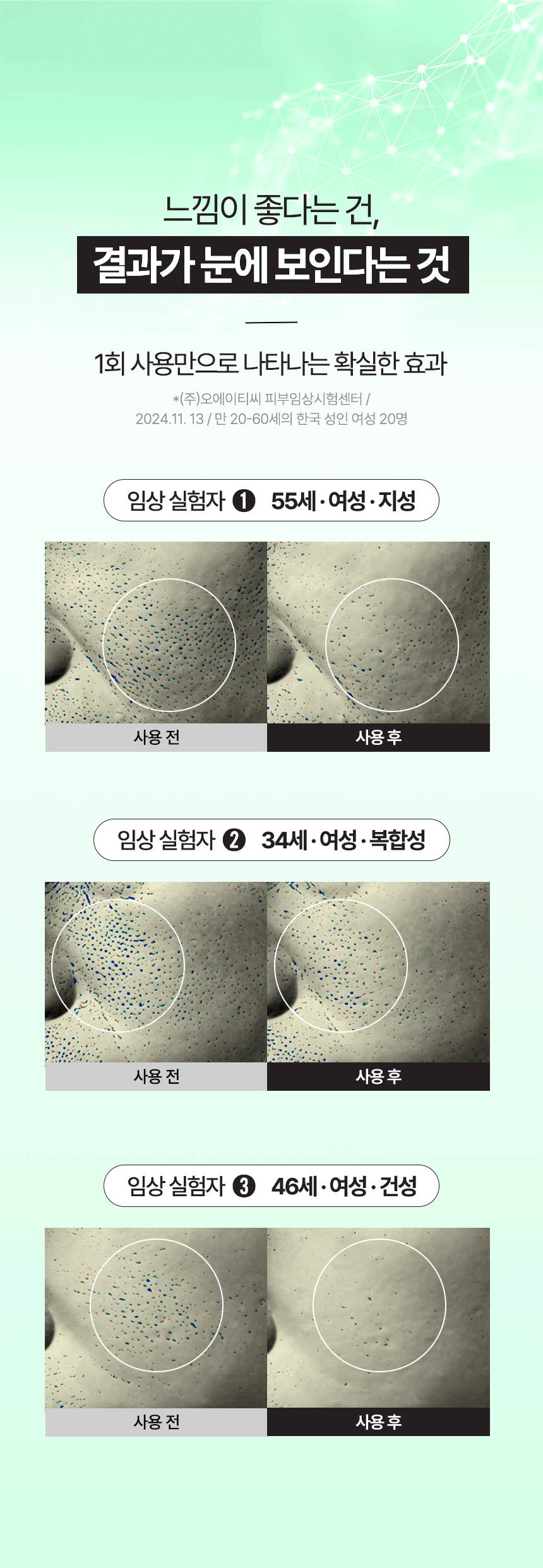 토너패드 상세이미지 12