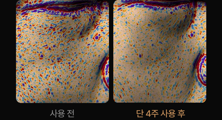 영롱한골드손패치 상세이미지