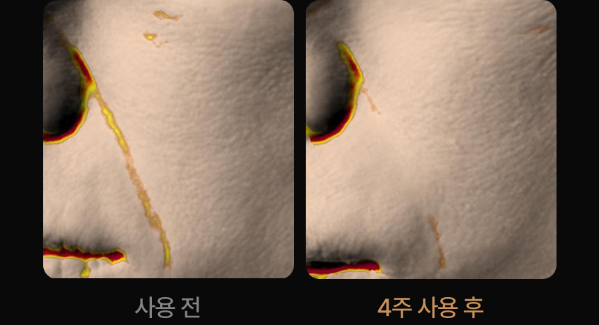 영롱한골드손패치 상세이미지