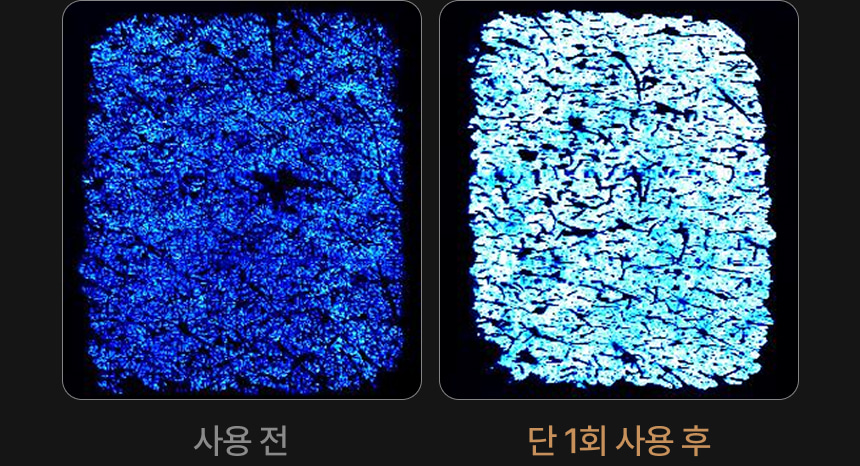 영롱한골드손패치 상세이미지