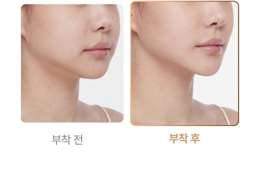 영롱한골드손패치 상세이미지