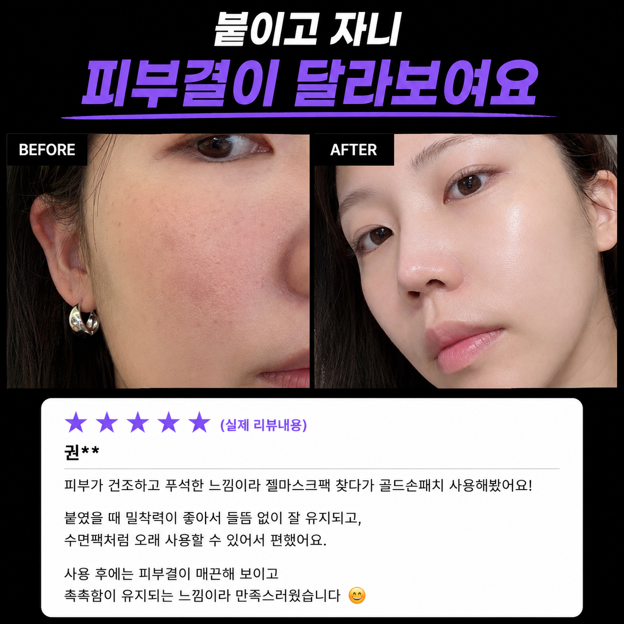 영롱한골드손패치 상세이미지